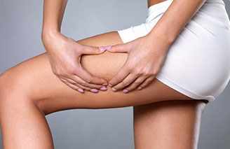 donna che controlla pelle a buccia d'arancia e cellulite sulla gamba