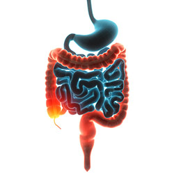 immagine di uno intestino in nero e colon in arancione