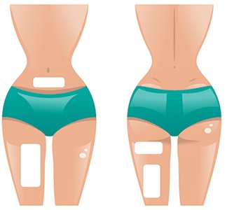 grafica di corpo di donna con cerotti dimagranti attaccati su diverse posizioni corpo grafica di corpo di donna con cerotti dimagranti attaccati su diverse posizioni corpo
