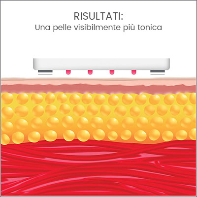 infografica risultati su cellulite e grasso adiposo pelle più liscia infografica risultati su cellulite e grasso adiposo pelle più liscia