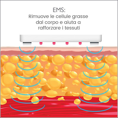 infografica lllt terapia laser bassa intensità per rimuovere cellule grasse adiposo infografica lllt terapia laser bassa intensità per rimuovere cellule grasse adiposo